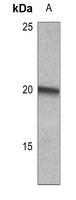 Myosin Light Chain 2 (Phospho-Ser19) Antibody