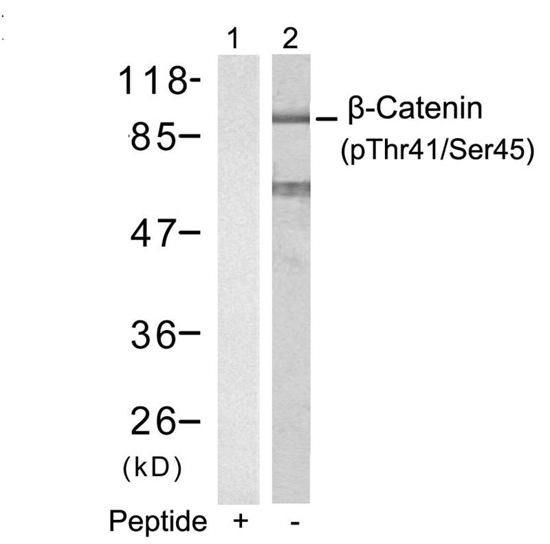 β-Catenin (Phospho-Thr41/Ser45) Antibody