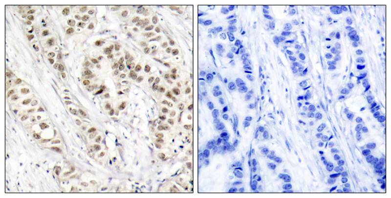 BRCA1 (Phospho-Ser1524) Antibody