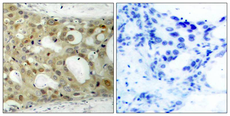 Androgen Receptor (Phospho-Ser650) Antibody
