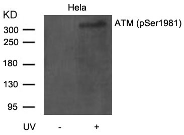 ATM (Phospho-Ser1981) Antibody