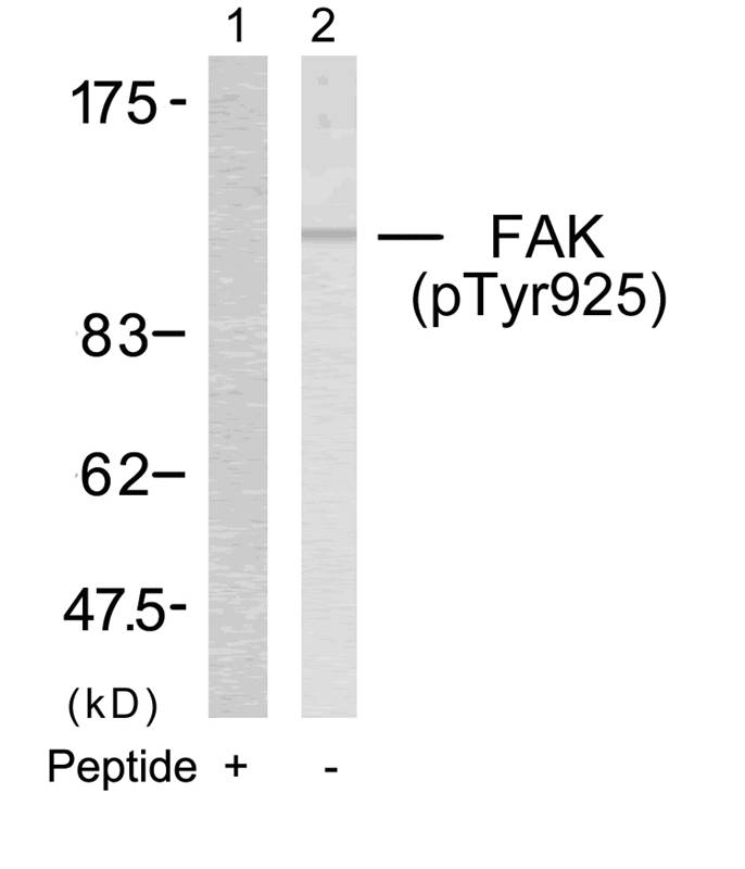 FAK (Phospho-Tyr925) Antibody