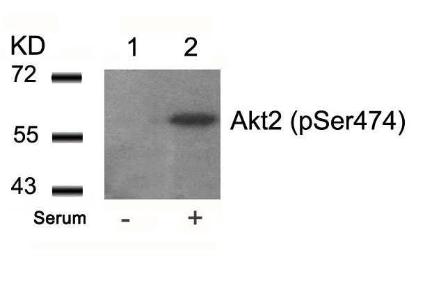 Akt2 (Phospho-Ser474) Antibody