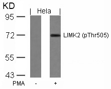 LIMK2 (Phospho-Thr505) Antibody