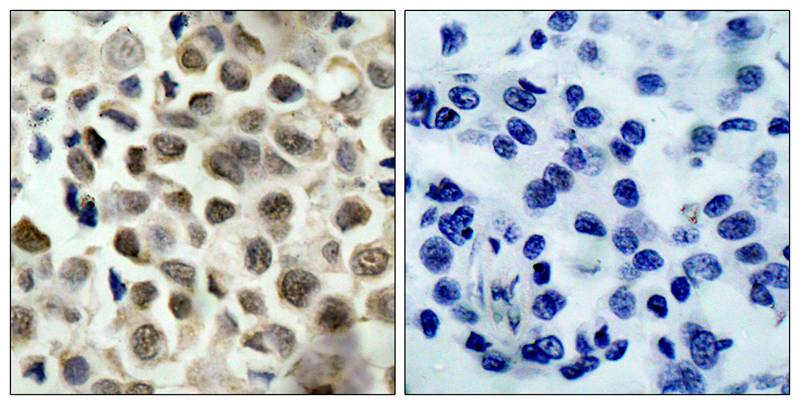 HDAC8 (Phospho-Ser39) Antibody