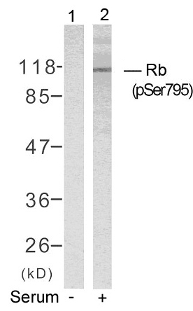Rb (Phospho-Ser795) Antibody