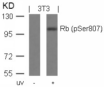 Rb (Phospho-Ser807) Antibody