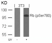 Rb (Phospho-Ser780) Antibody
