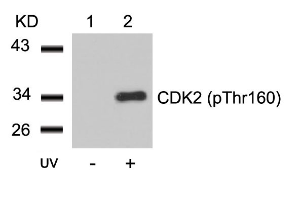 CDK2 (Phospho-Thr160) Antibody