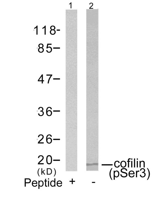 cofilin (Phospho-Ser3) Antibody