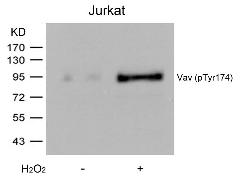 Vav (Phospho-Tyr174) Antibody