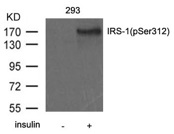 IRS(Phospho-Ser312) Antibody