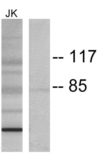 Lck (Phospho-Tyr394) Antibody