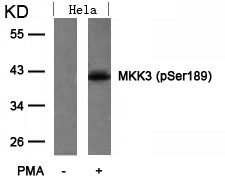 MKK3 (Phospho-Ser189) Antibody