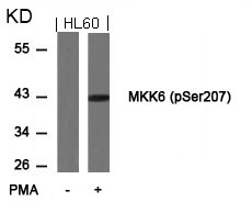 MKK6 (Phospho-Ser207) Antibody