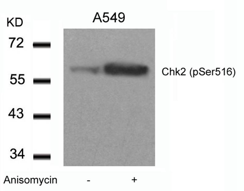 Chk2 (Phospho-Ser516) Antibody