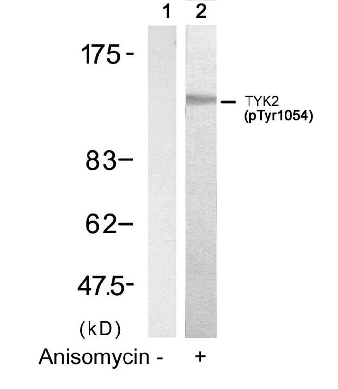 TYK2(Phospho-Tyr1054/1055) Antibody