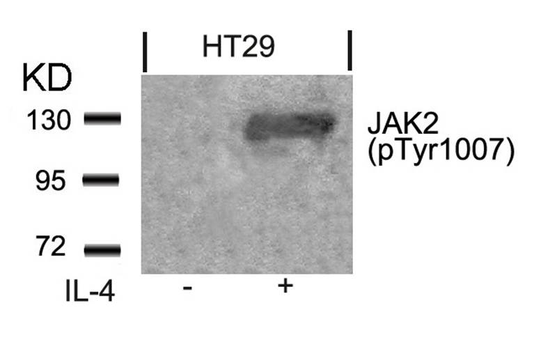 JAK2 (Phospho-Tyr1007) Antibody