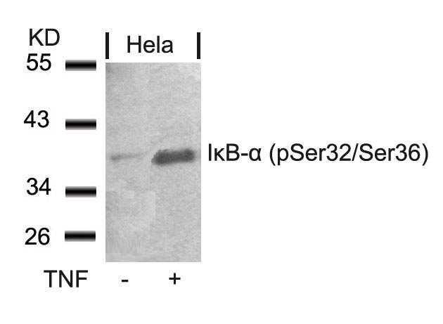 IκB-α (Phospho-Ser32/Ser36) Antibody
