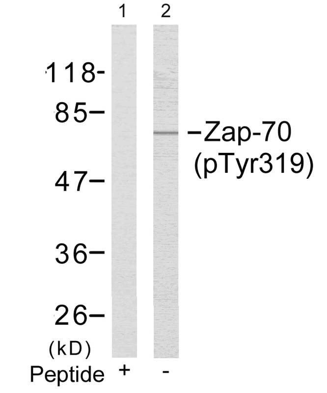 Zap-70 (Phospho-Tyr319) Antibody