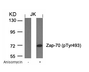 Zap-70 (Phospho-Tyr493) Antibody
