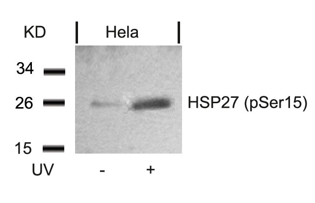 HSP27 (Phospho-Ser15) Antibody