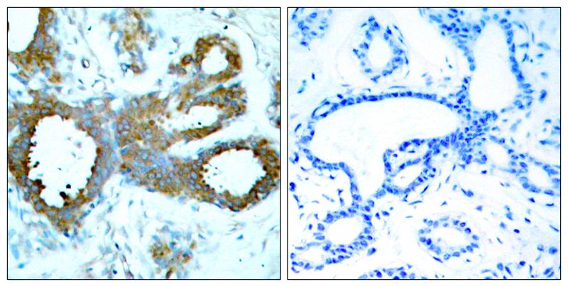 PAK1/PAK2/PAK3 (Phospho-Thr423/Thr402/Thr421) Antibody