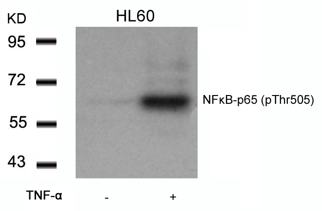 NFκB-p65 (Phospho-Thr505) Antibody