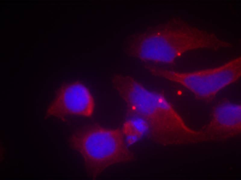NMDAR2B (phospho-Tyr1474) Antibody