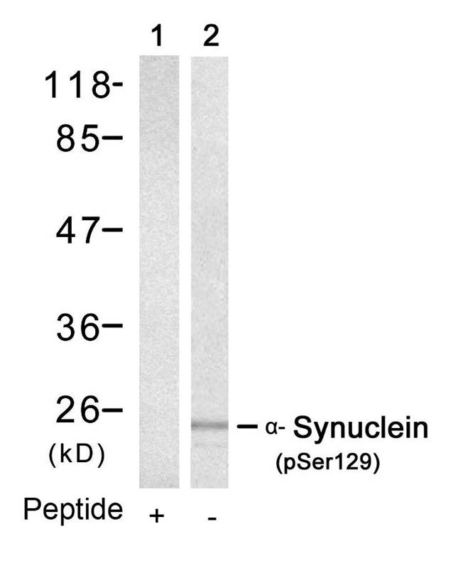 α-Synuclein (Phospho-Ser129) Antibody