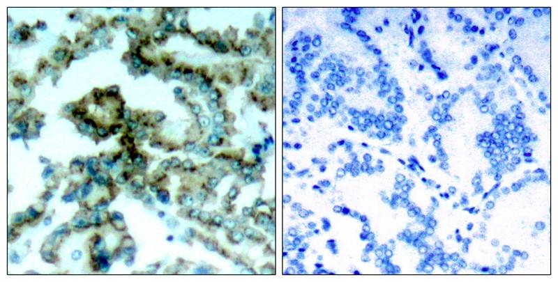 PKCβ (Phospho-Thr641) Antibody
