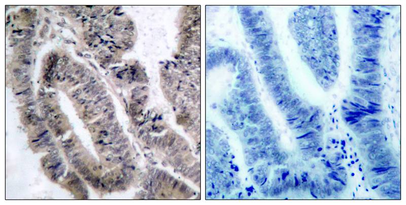 AMPKα1 (Phospho-Ser496)Antibody
