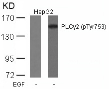 PLCγ2 (Phospho-Tyr753) Antibody