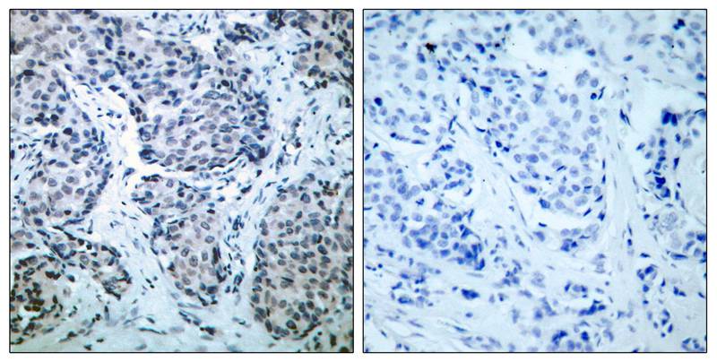 SEK1/MKK4 (Phospho-Thr261) Antibody