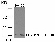 SEK1/MKK4 (Phospho-Ser80) Antibody
