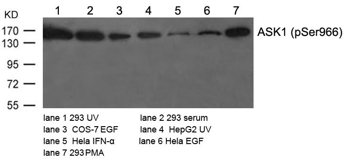 ASK1 (Phospho-Ser966) Antibody