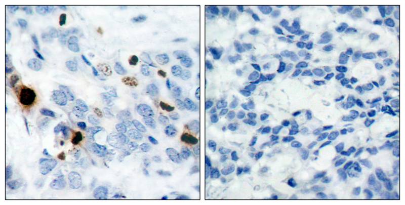 Histone H3.1 (Phospho-Ser10) Antibody