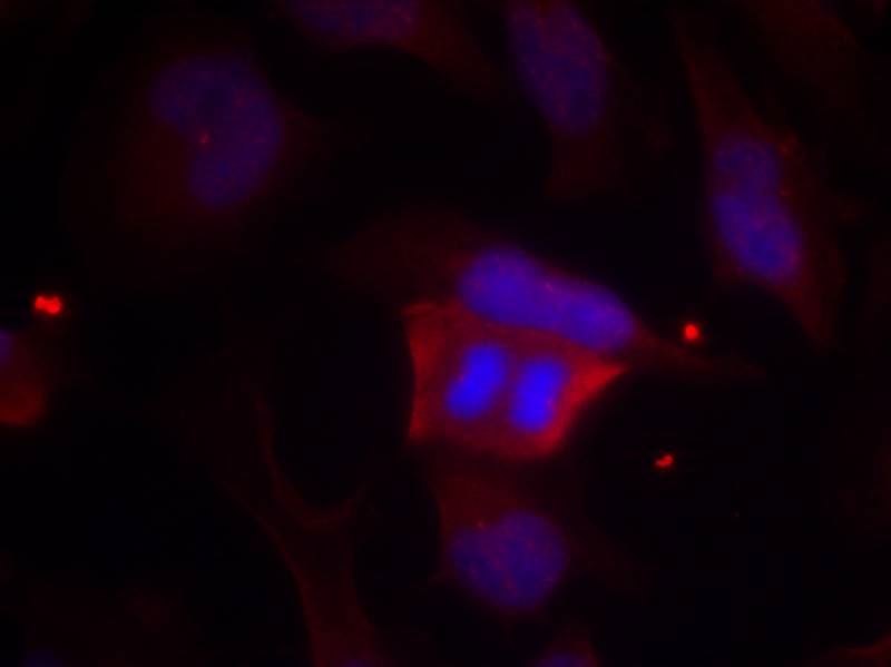 DARPP-32 (Phospho-Thr75) Antibody