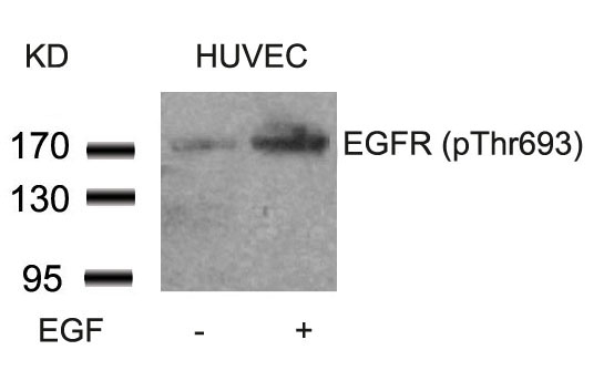 EGFR (Phospho-Thr693) Antibody