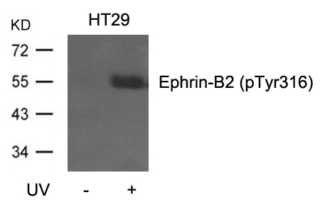 Ephrin-B2 (Phospho-Tyr316) Antibody