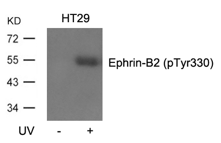 Ephrin-B2 (Phospho-Tyr330) Antibody