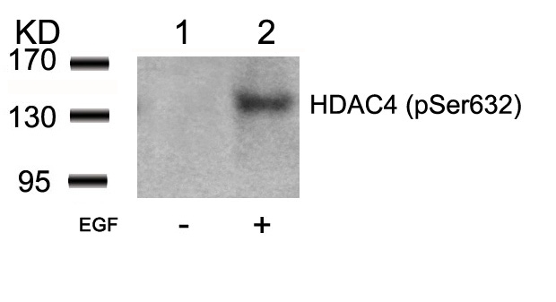 HDAC4 (Phospho-Ser632) Antibody
