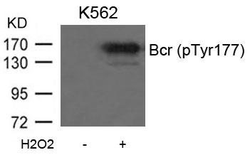 Bcr (Phospho-Tyr177) Antibody