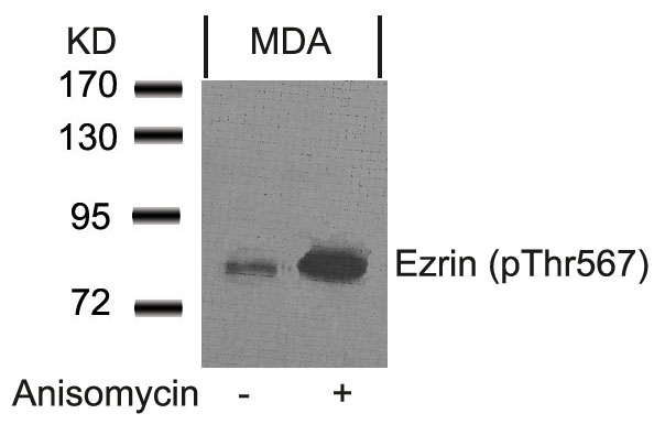 Ezrin (Phospho-Thr567) Antibody