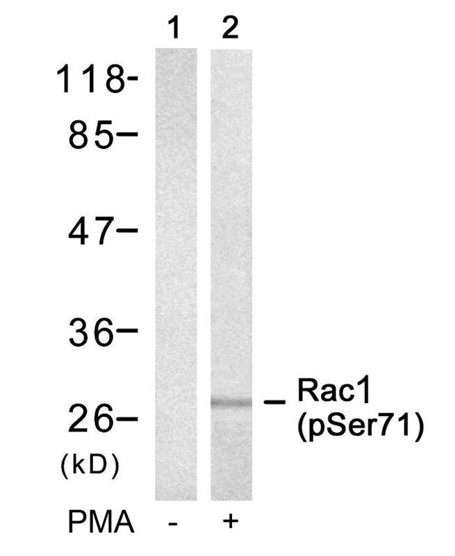 Rac1 (Phospho-Ser71) Antibody