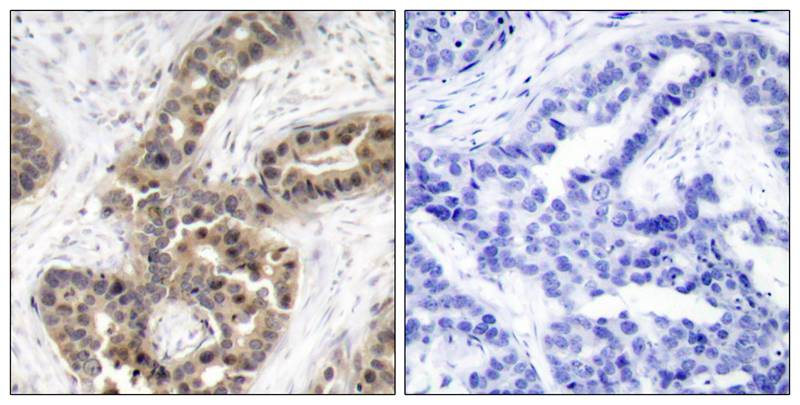 p21Cip1 (Phospho-Thr145) Antibody