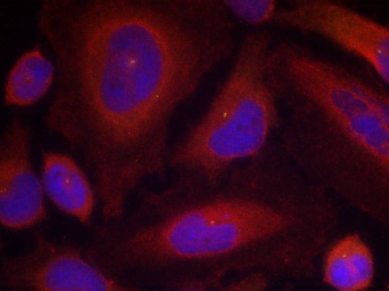 Synaptotagmin 1 (Phospho-Ser309) Antibody