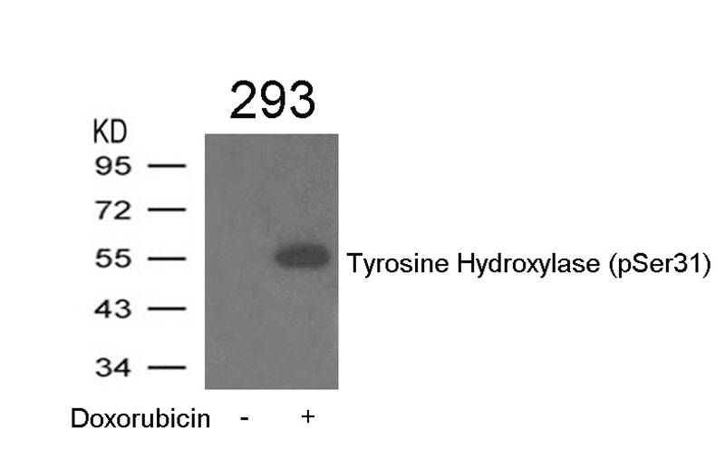 Tyrosine Hydroxylase (Phospho-Ser31) Antibody