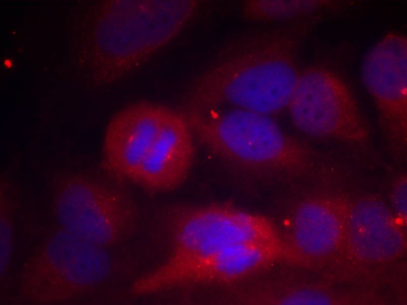 Tyrosine Hydroxylase (Phospho-Ser40) Antibody