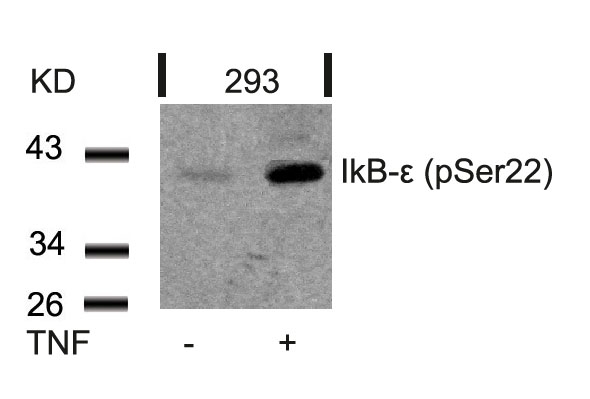 IkB-ε (Phospho-Ser22) Antibody
